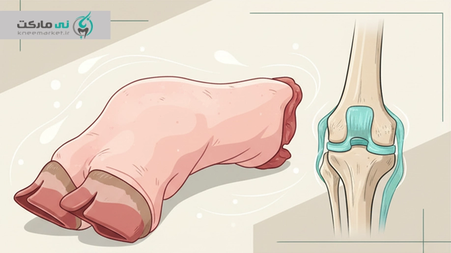 پاچه گوساله برای زانو
